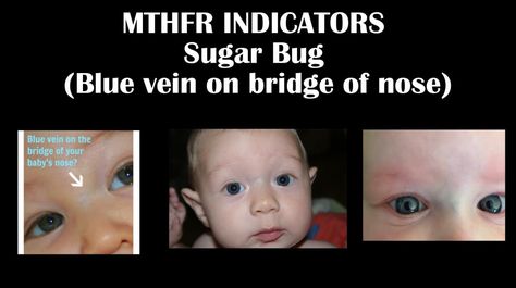 Mutacja genu MTHFR u dziecka 