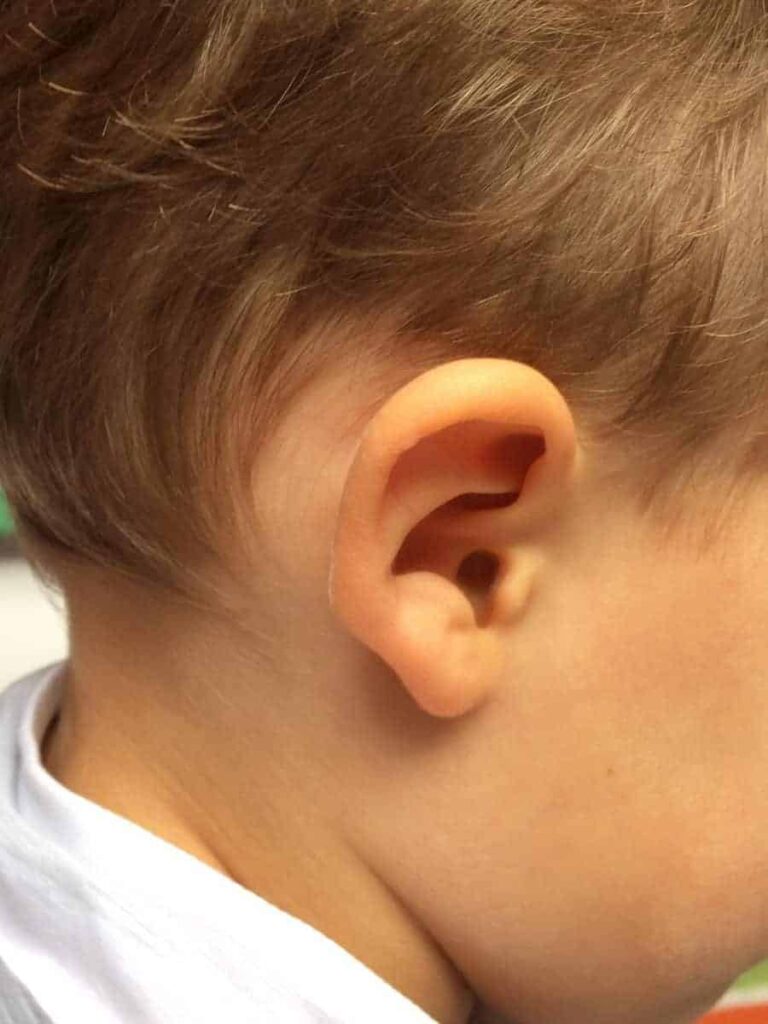 10 naturalnych sposobów na ból ucha, punkty 7 i 8 wymiatają